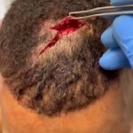 Fotos de la desagradable herida en la cabeza de Danny Roberts de UFC Fight Night 195