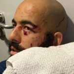 El portero Danilo Fernandes, de Bahía, casi recibe un golpe en el ojo izquierdo