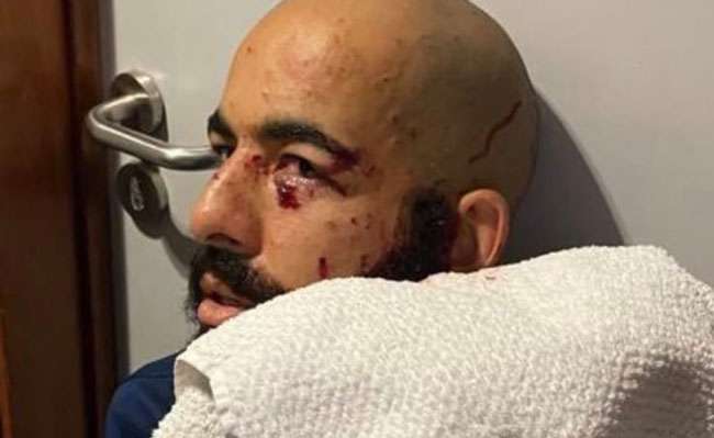 El portero Danilo Fernandes, de Bahía, casi recibe un golpe en el ojo izquierdo