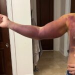 Cody Rhodes mostró más fotos espantosas de su lesión de terror