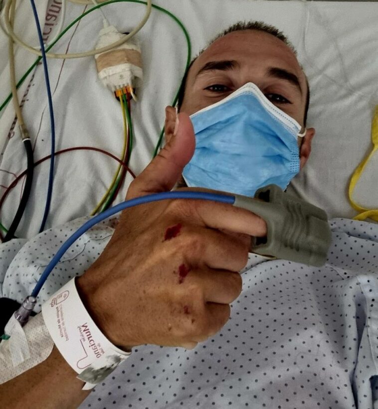 Valverde hospitalizado tras ser atropellado por el conductor de un automóvil en un incidente de atropello y fuga