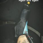 Neymar maldijo su suerte al publicar una foto de su bota protectora después de torcerse el tobillo