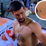 ¡Novak Djokovic reveló cuál es el dispositivo que lleva en el pecho!