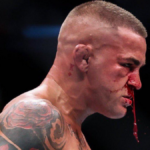 Dustin Poirier revela varias lesiones horripilantes después de UFC 302
