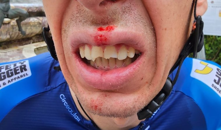 Jan Hirt se rompe los dientes después de que los fanáticos invadieran el paddock del equipo en el Tour de Francia