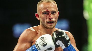 Sunny Edwards sufrió un gran corte sobre su ojo derecho durante una pelea en Arizona el sábado.