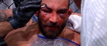 Los luchadores de UFC reaccionan a las graves lesiones de Benoit Saint-Denis y la victoria por nocaut técnico de Renato Moicano